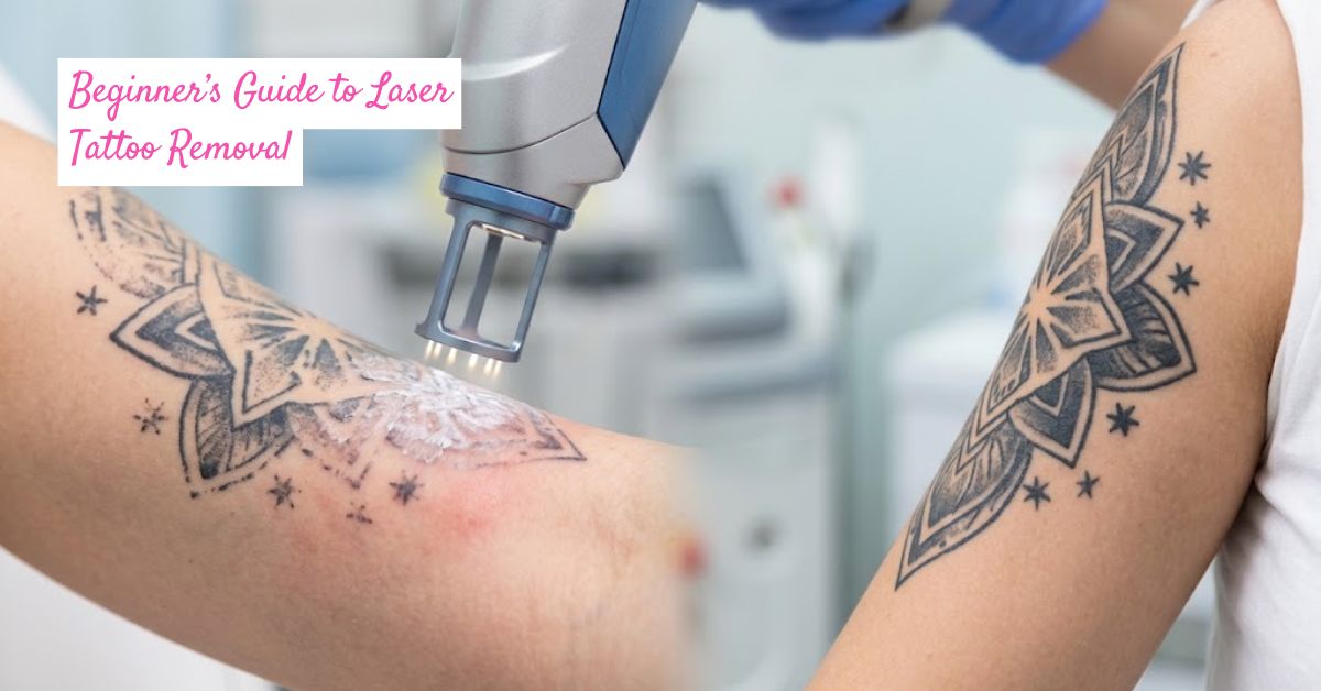Beginner's Guide to Laser Tattoo Removal
